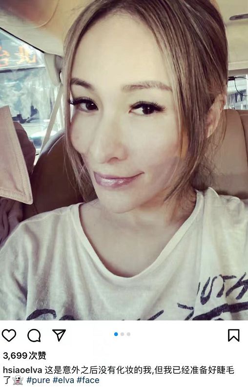 萧亚轩被狗咬后素颜晒疤！下巴布满增生伤痕