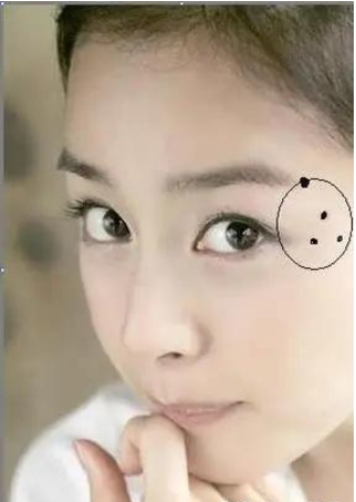 面相揭秘：女人脸上的桃花痣